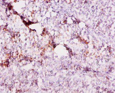 CD59 Antibody