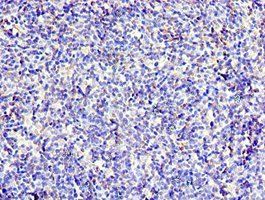 CD6 Antibody