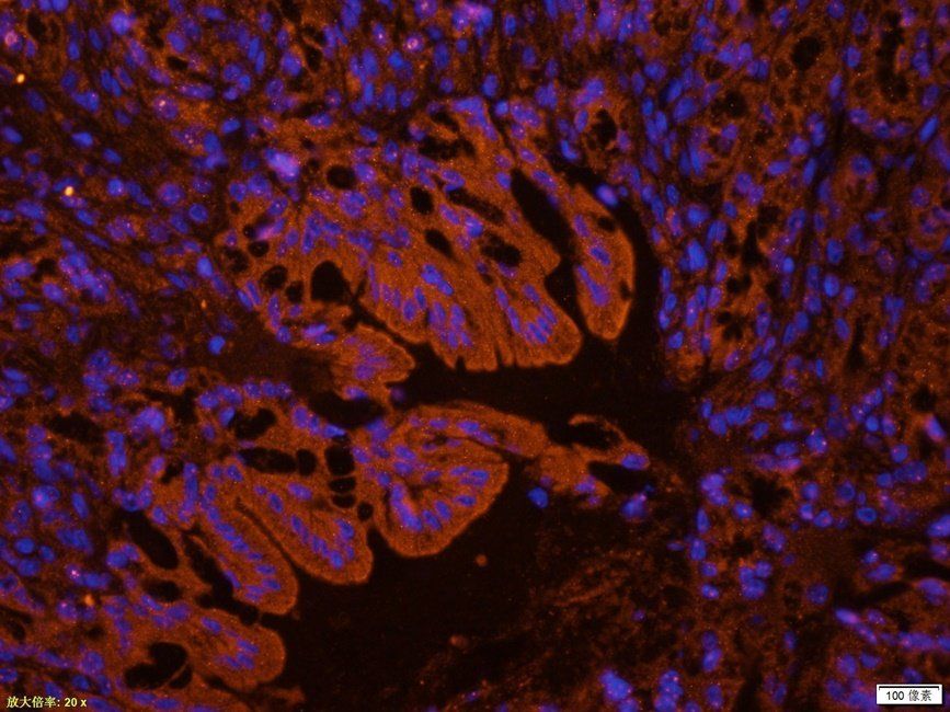 CD62E Rabbit Polyclonal Antibody