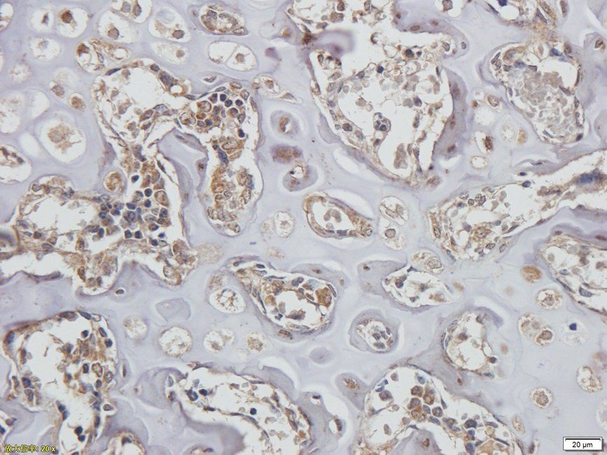 CD62E Rabbit Polyclonal Antibody