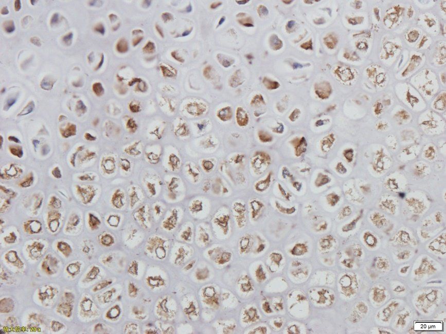 CD62E Rabbit Polyclonal Antibody