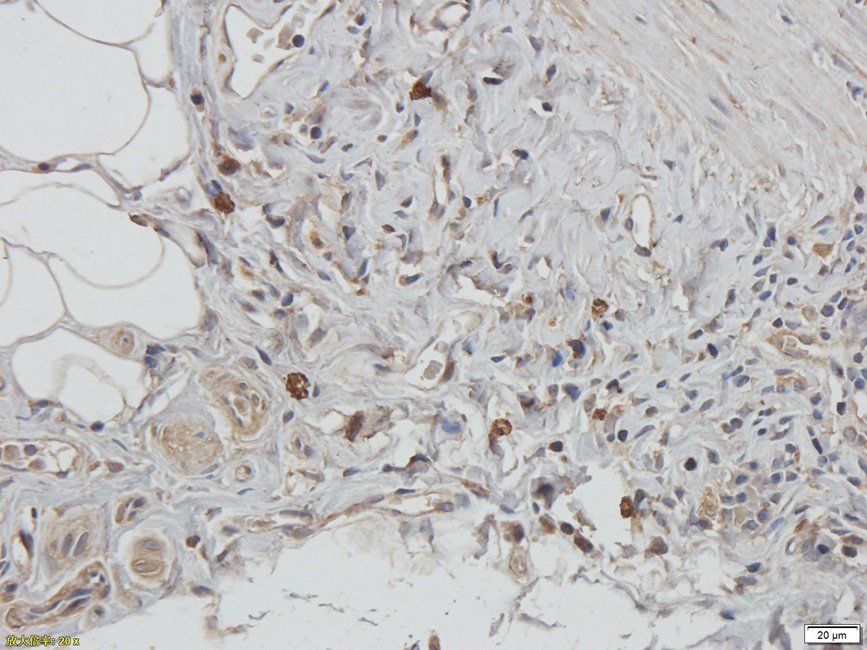 CD62E Rabbit Polyclonal Antibody