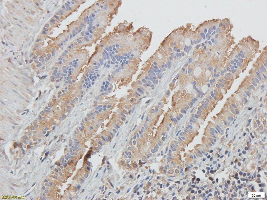 CD62E Rabbit Polyclonal Antibody