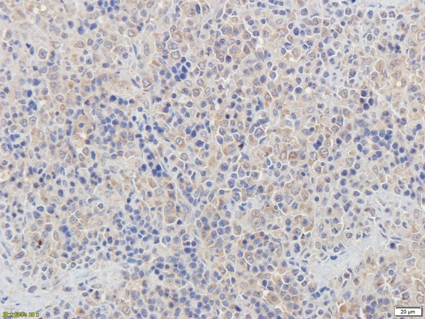CD62E Rabbit Polyclonal Antibody