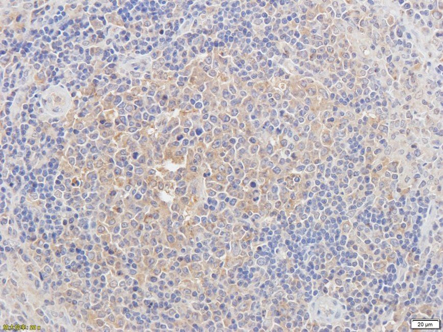 CD62E Rabbit Polyclonal Antibody