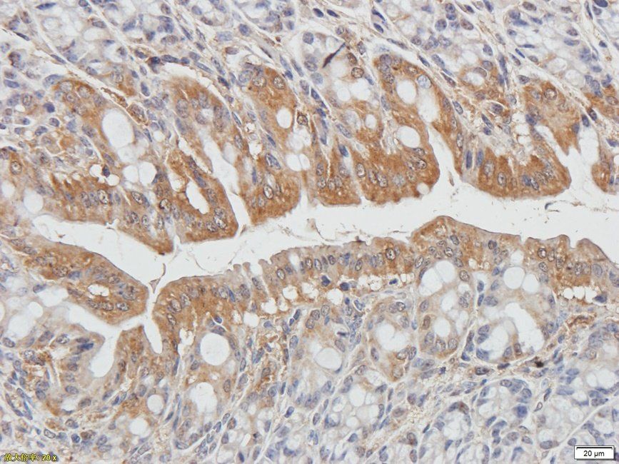 CD62E Rabbit Polyclonal Antibody