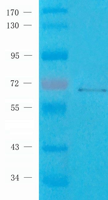 CD62E Rabbit Polyclonal Antibody