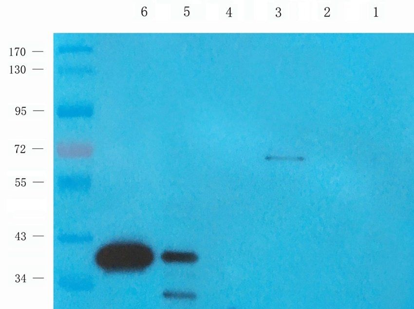 CD62E Rabbit Polyclonal Antibody