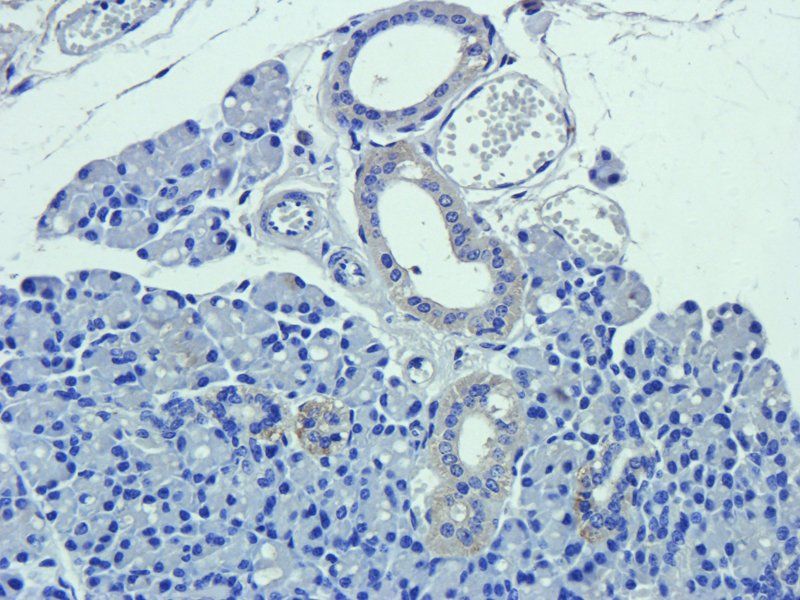 CD63 Rabbit Polyclonal Antibody
