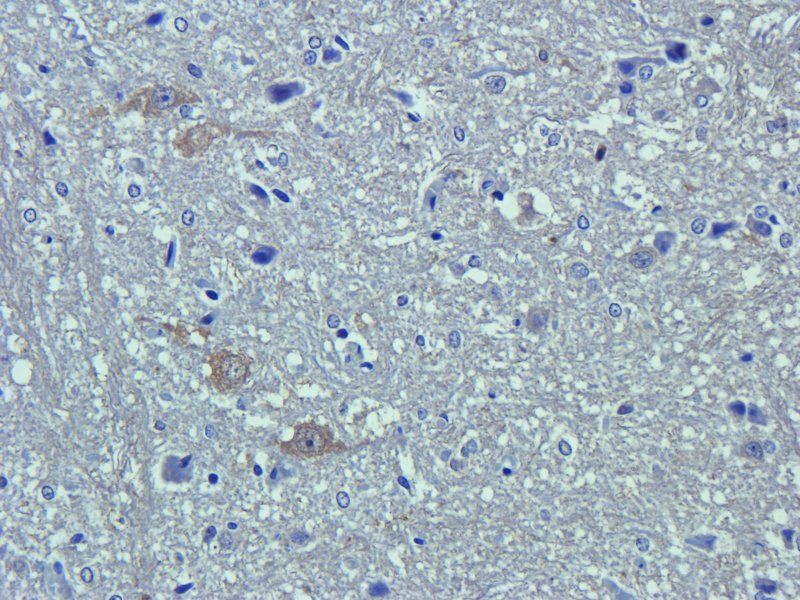 CD63 Rabbit Polyclonal Antibody
