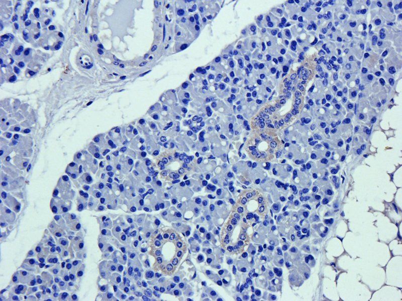 CD63 Rabbit Polyclonal Antibody