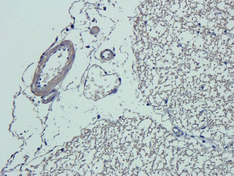 CD63 Rabbit Polyclonal Antibody