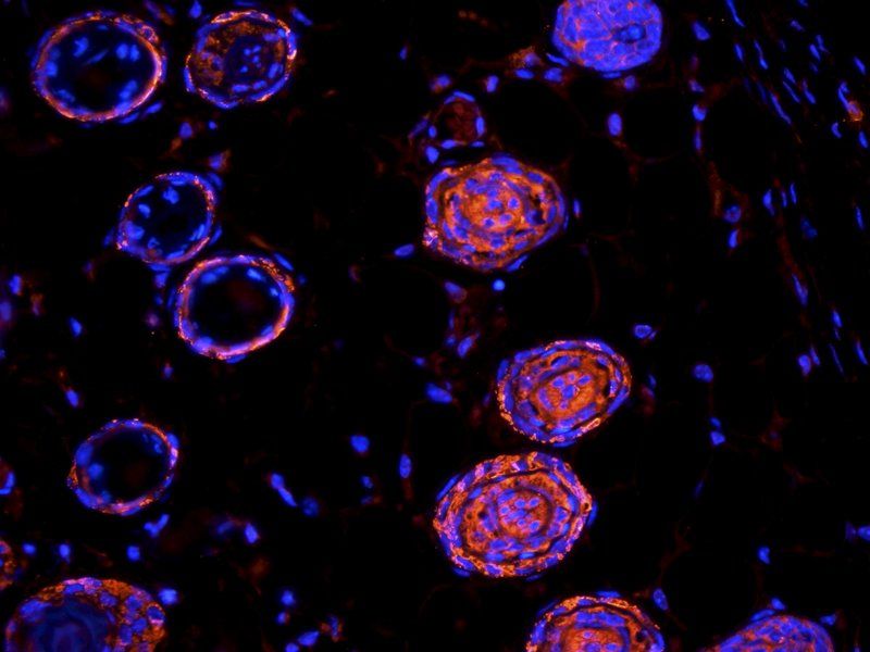 CD63 Rabbit Polyclonal Antibody