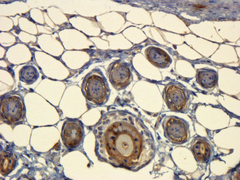 CD63 Rabbit Polyclonal Antibody