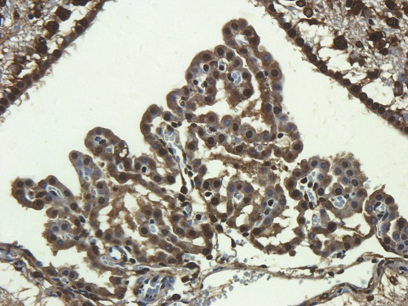 CD68 Rabbit Polyclonal Antibody