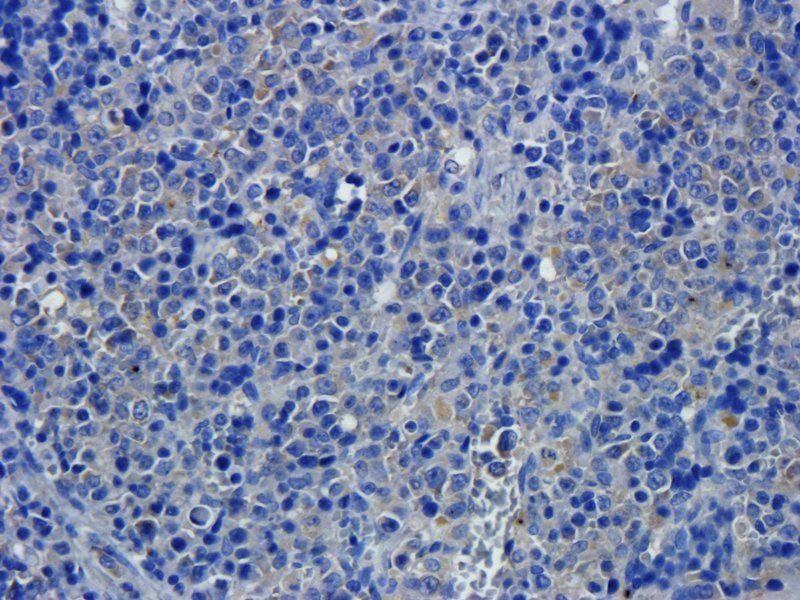 CD68 Rabbit Polyclonal Antibody