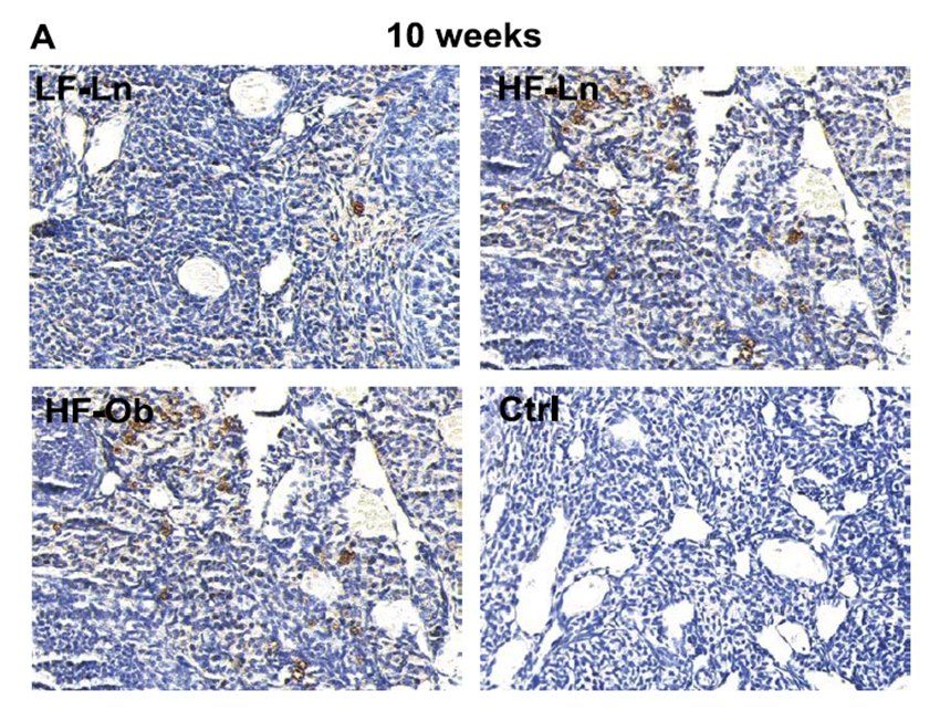 CD68 Rabbit Polyclonal Antibody