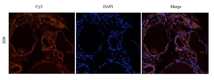 CD69 Rabbit Polyclonal Antibody