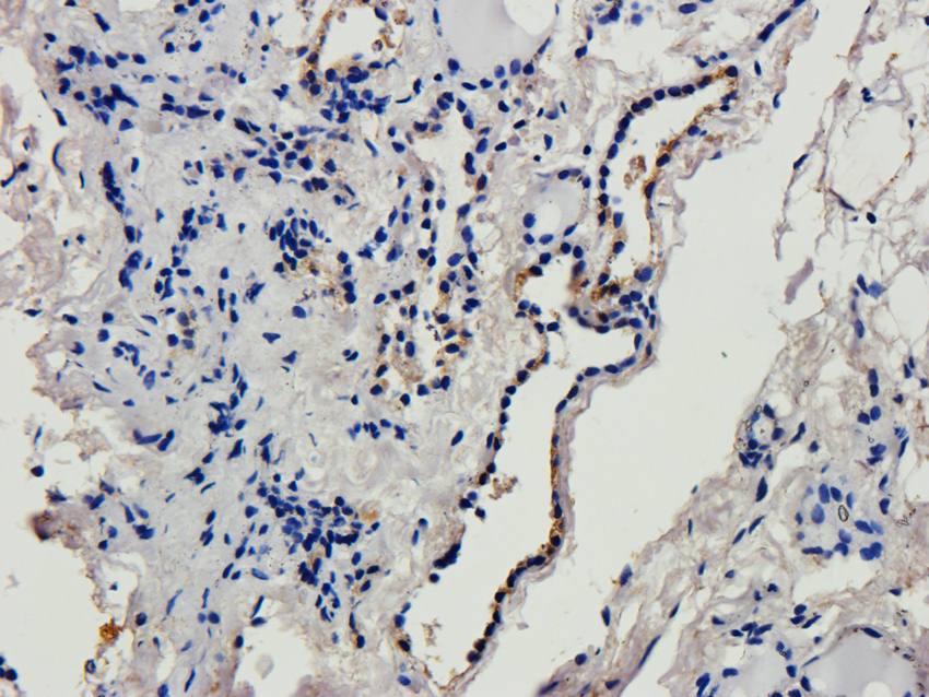 CD69 Rabbit Polyclonal Antibody
