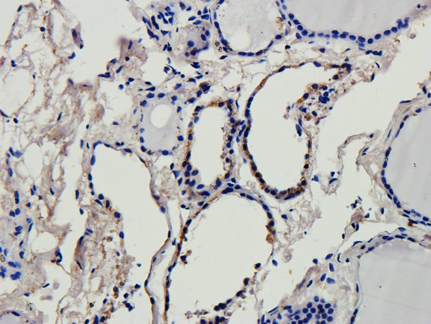 CD69 Rabbit Polyclonal Antibody