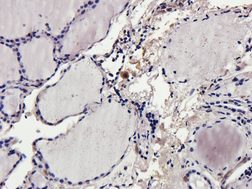 CD69 Rabbit Polyclonal Antibody
