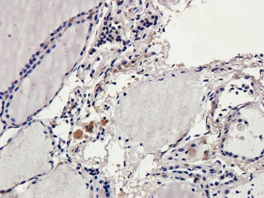 CD69 Rabbit Polyclonal Antibody
