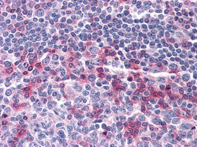 CD69 Antibody