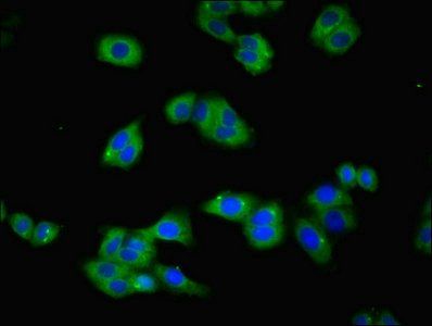 TFRC Antibody