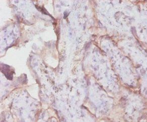 TFRC Antibody