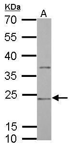 CD74 Rabbit Polyclonal Antibody