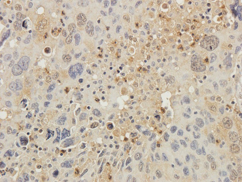 CD81 Rabbit Polyclonal Antibody