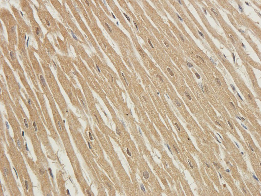 CD81 Rabbit Polyclonal Antibody