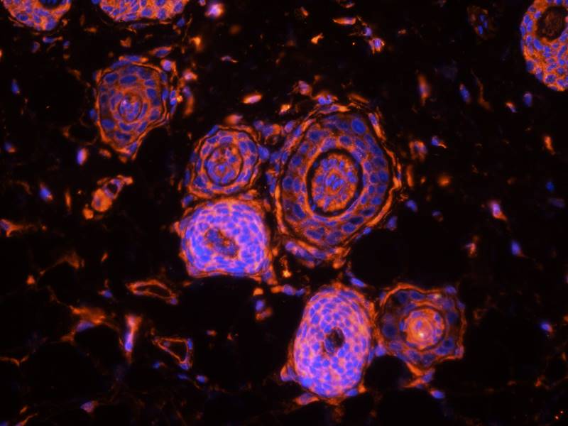 CD81 Rabbit Polyclonal Antibody