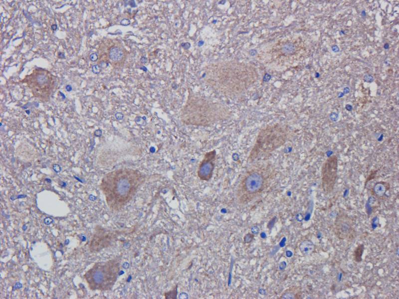 CD81 Rabbit Polyclonal Antibody