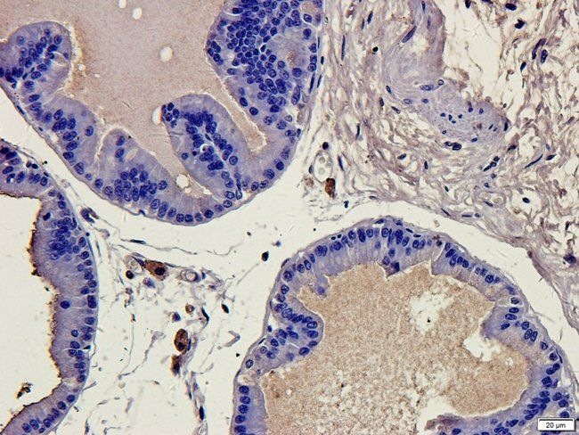 CD86 Rabbit Polyclonal Antibody