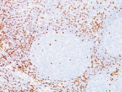 CD8A Antibody