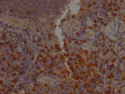 CD8A Antibody
