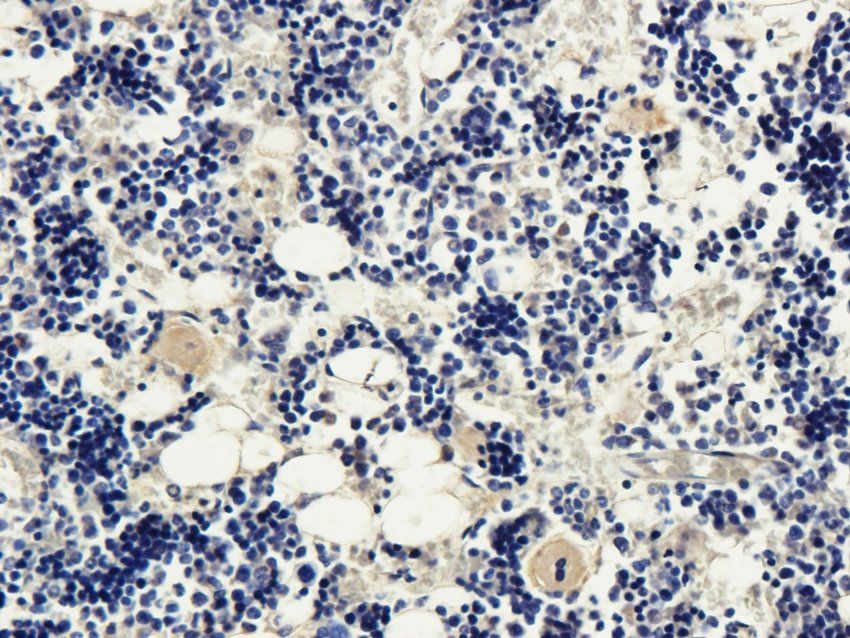 CD95 Rabbit Polyclonal Antibody