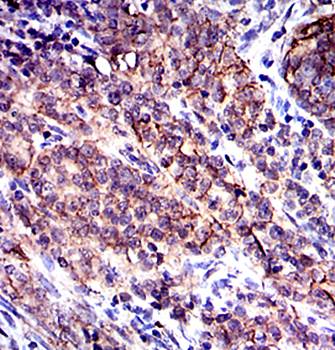 CD9 Antibody