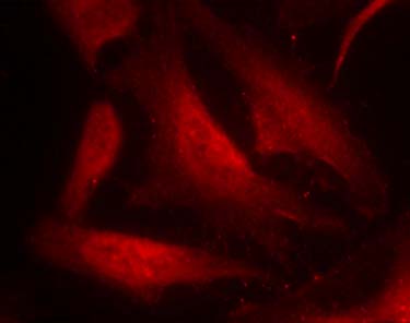 cdc25C (Phospho-Ser216) Antibody