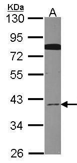 GOLPH2 Rabbit Polyclonal Antibody