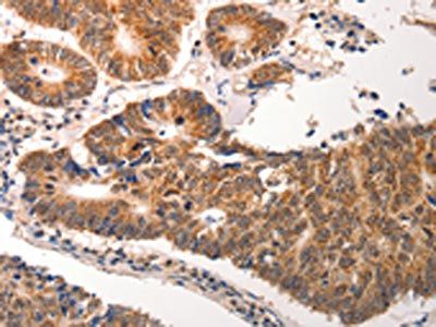 CDC6 Antibody