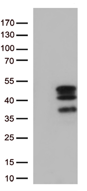 CDCA3 Antibody