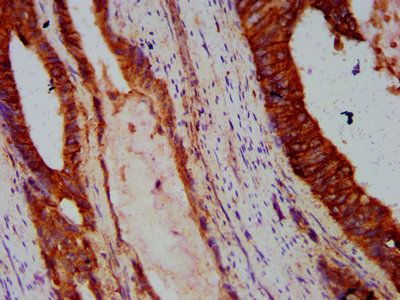 CDH1 Antibody