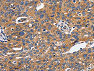 CDH1 Antibody