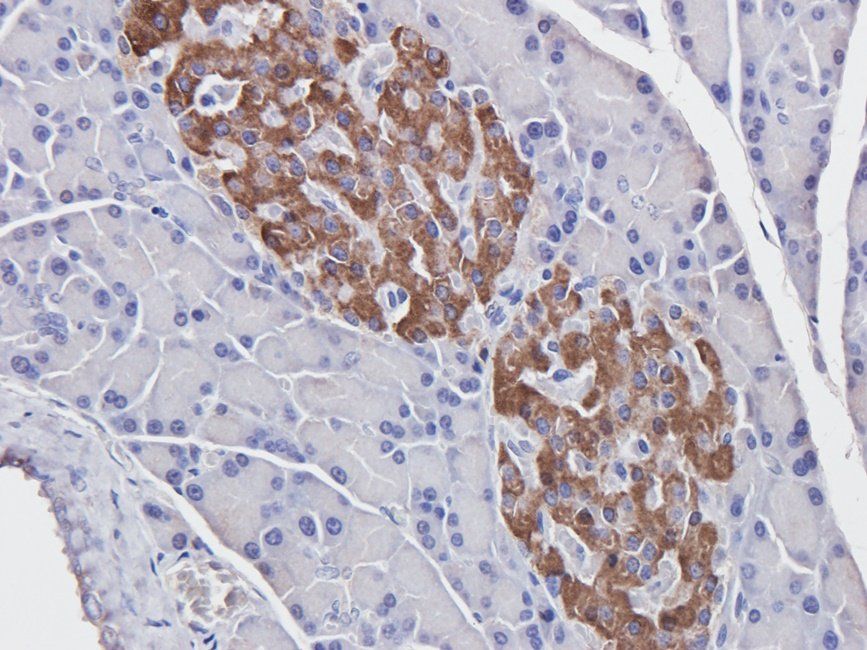 CDH17 Rabbit Polyclonal Antibody