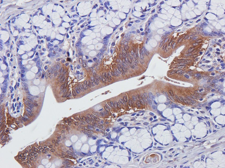 CDH17 Rabbit Polyclonal Antibody