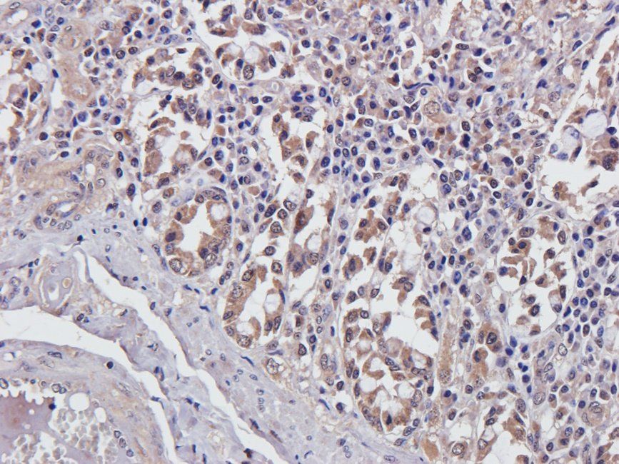 CDH17 Rabbit Polyclonal Antibody