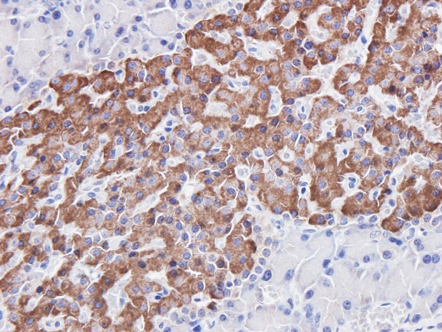 CDH17 Rabbit Polyclonal Antibody
