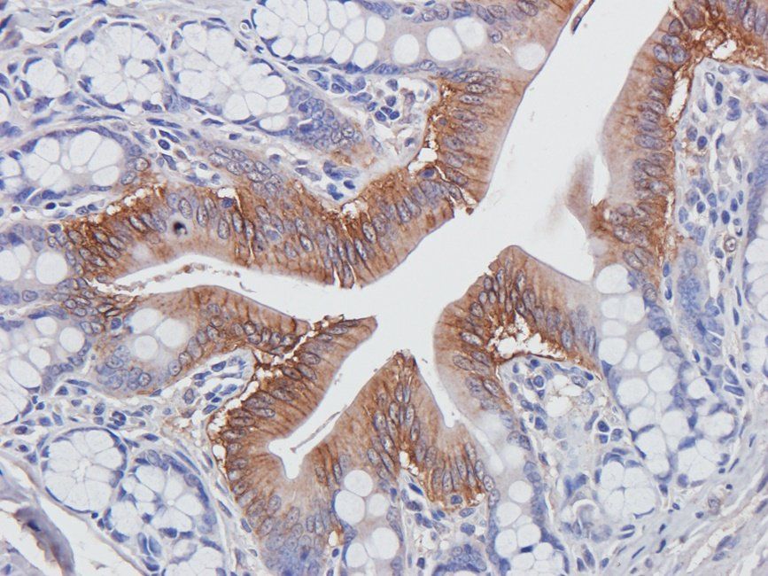 CDH17 Rabbit Polyclonal Antibody